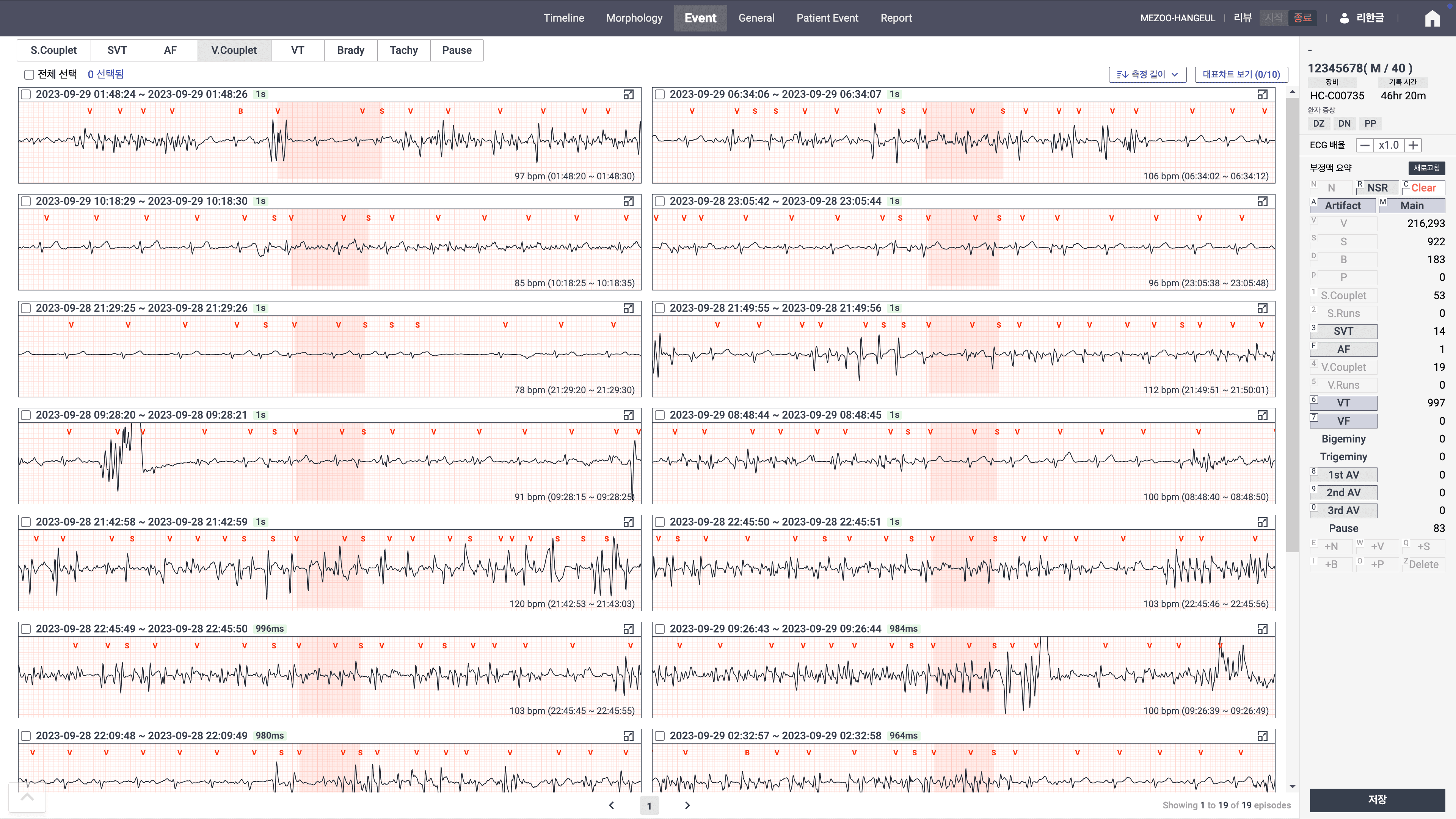 Holter Events 화면 — 이벤트 타임라인 탐색
