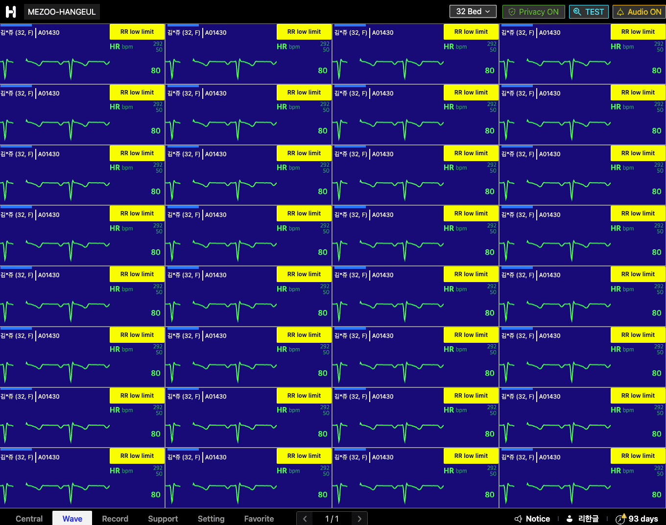 LiveStudio Monitor 화면 — 256병상 실시간 ECG · 바이탈 모니터링