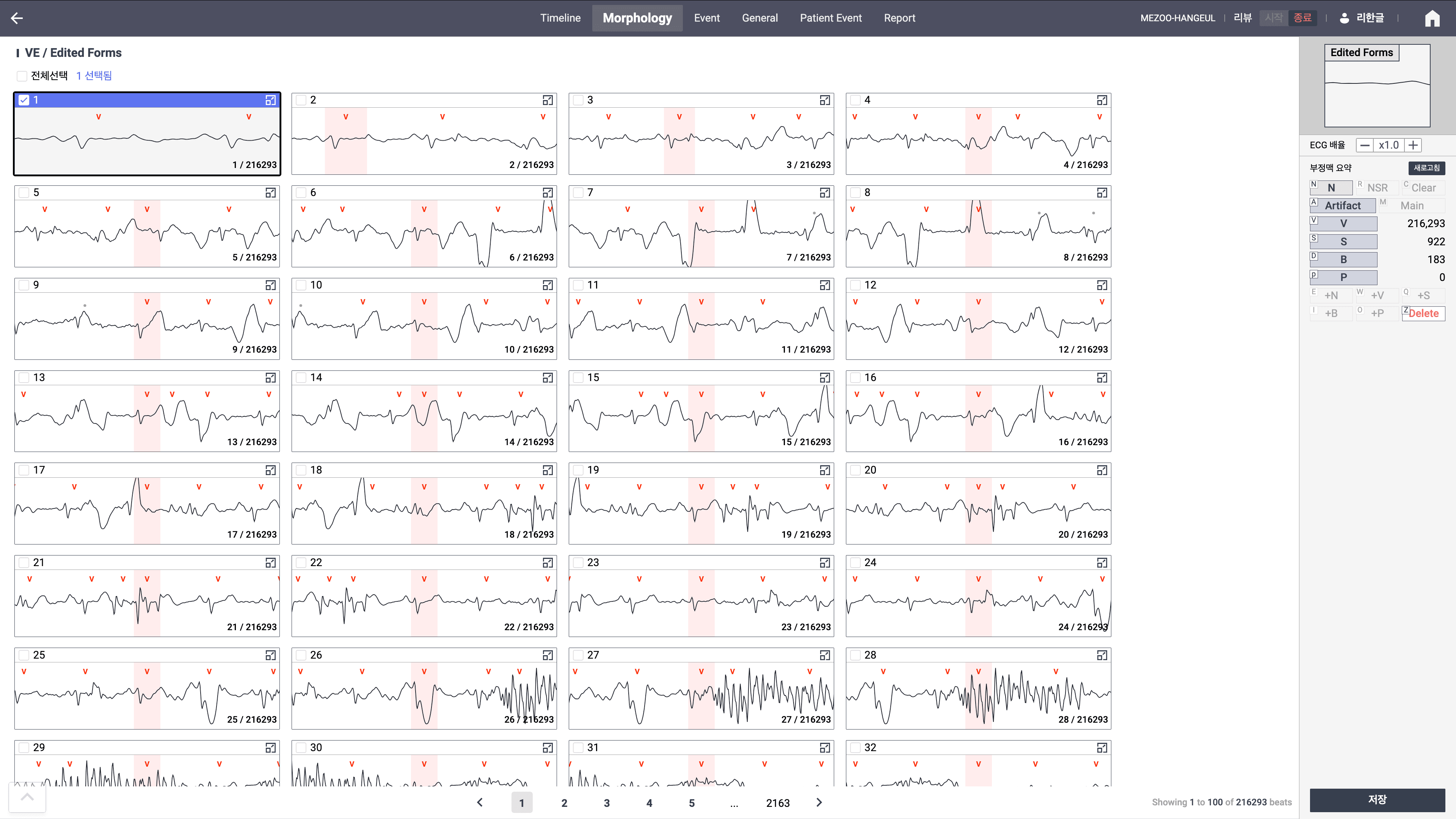 Holter Morphology 화면 — 비트 형태 분류 · 대량 파형 라벨링